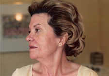 facelift1d