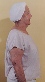 facelift3b